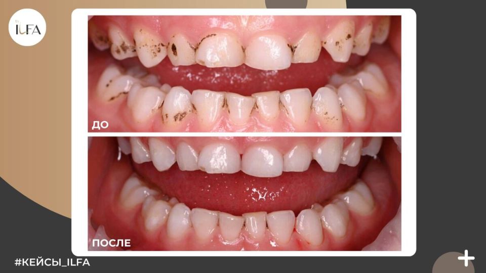 ���� �������: ��� ��� ����� � ��� ��� ���������� �������?