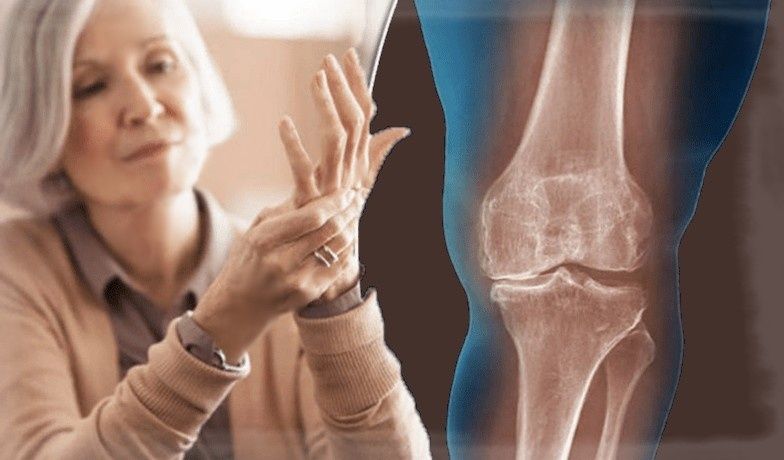 ������ � ������ ����� 55: ��� ��������� �������� � �����������