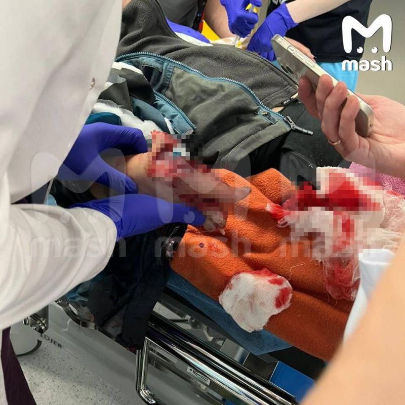 Сверток с деньгами взорвался у ребенка в руках в Красногорске