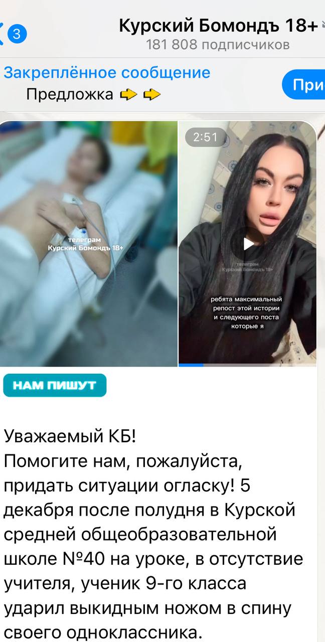 Проведение проверки по факту нанесения ножевого ранения находится на контроле у начальника управления МВД России по г.Курску