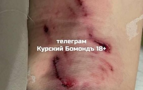 � ������ ����������� ������ �������� ����� ��������� � ��������� ������ �� ���������