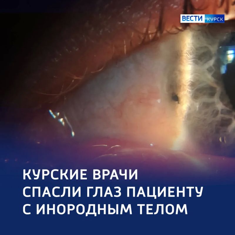 2,5 мм до слепоты: курянин едва не ослеп из-за осколка фанеры